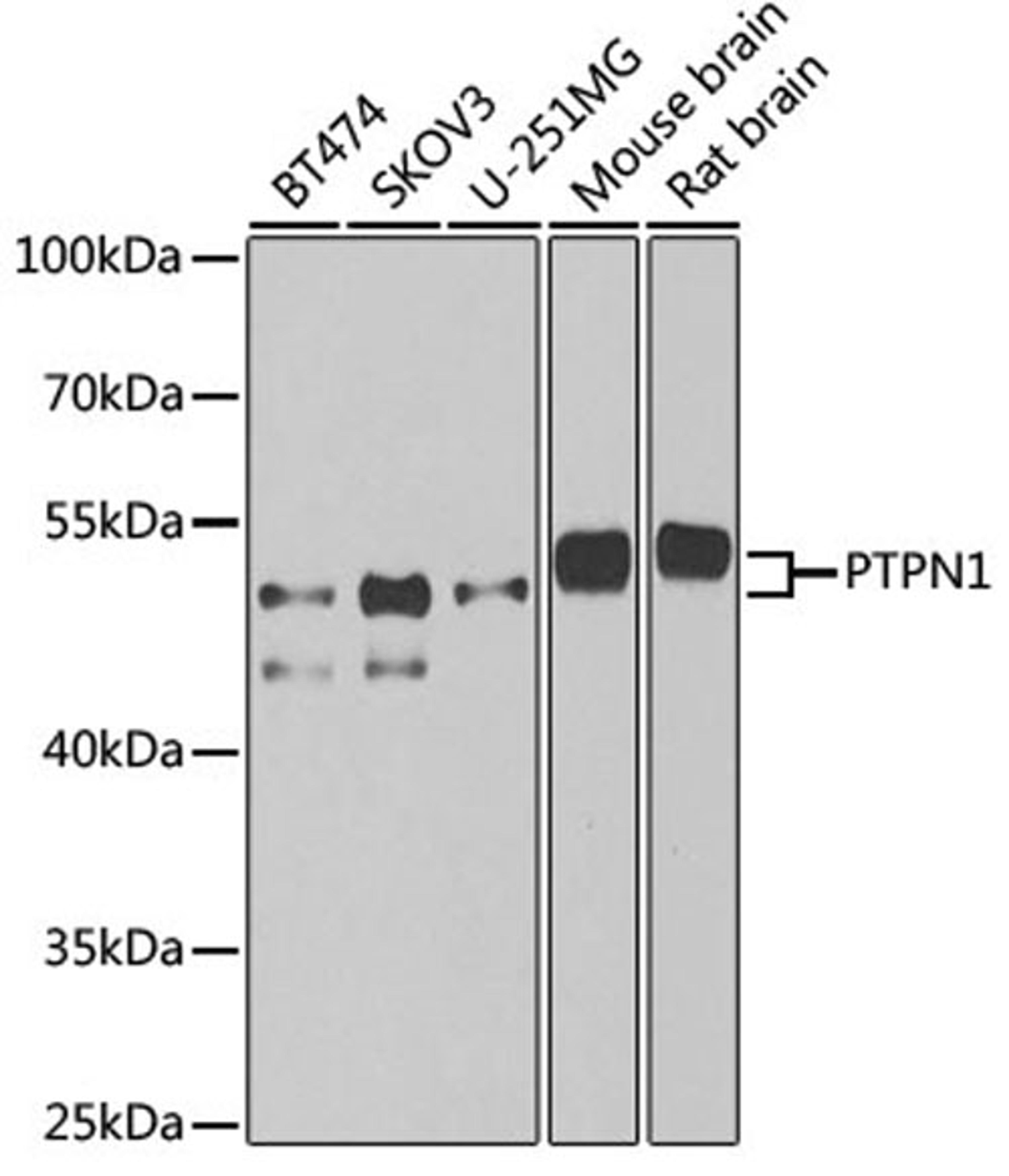 Western blot - PTPN1 antibody (A1590)