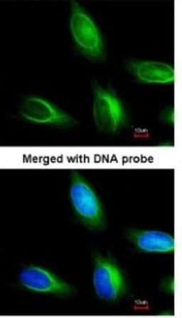 Immunocytochemistry/Immunofluorescence: MTMR4 Antibody [NBP1-32402] - Paraformaldehyde-fixed HeLa, using antibody at 1:200 dilution.