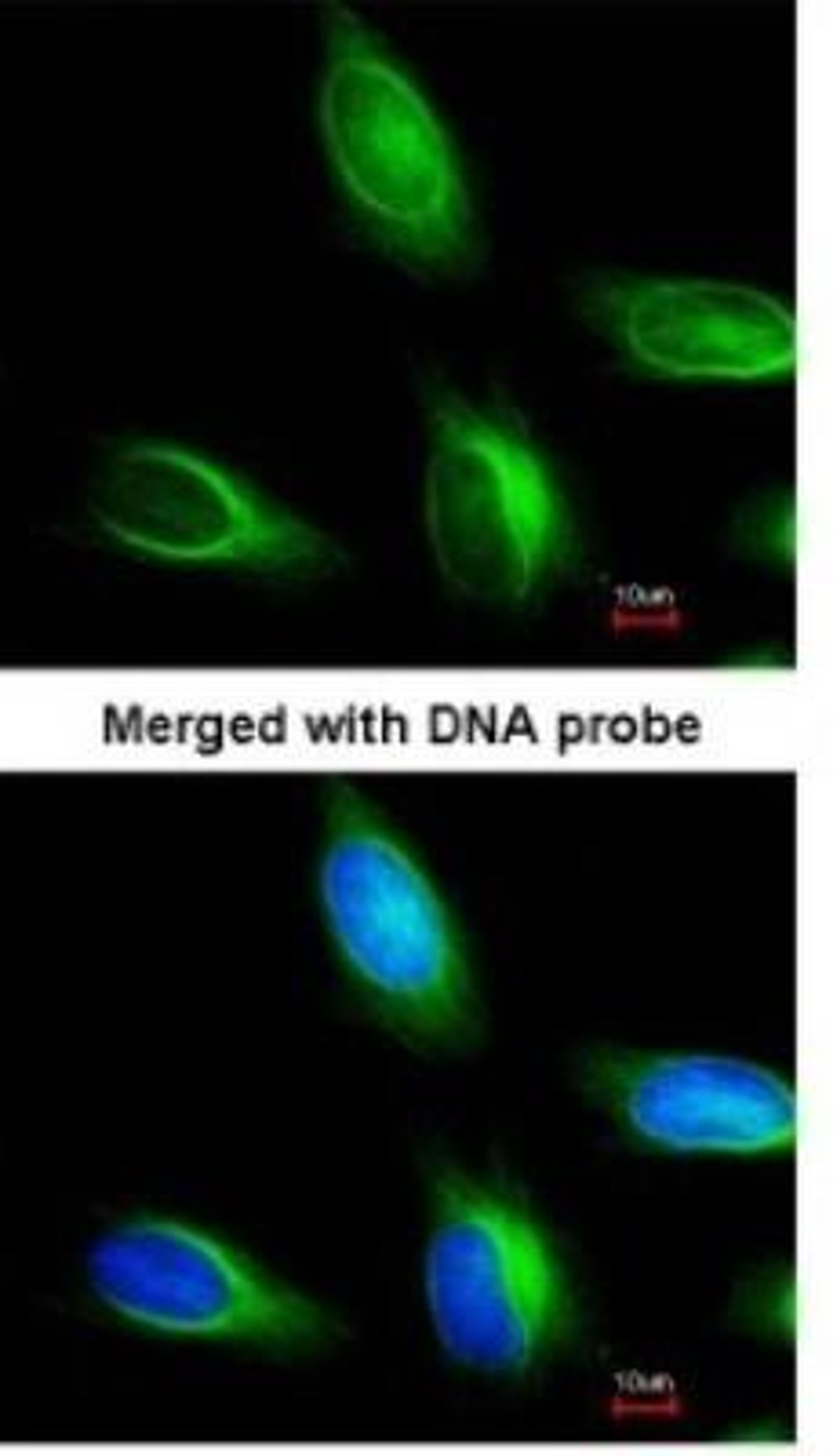 Immunocytochemistry/Immunofluorescence: MTMR4 Antibody [NBP1-32402] - Paraformaldehyde-fixed HeLa, using antibody at 1:200 dilution.