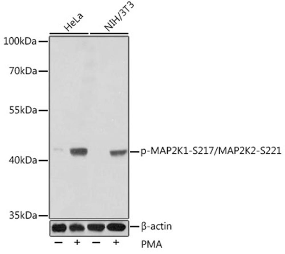 Western blot - Phospho-MAP2K1-S217/MAP2K2-S221 antibody (AP0209)