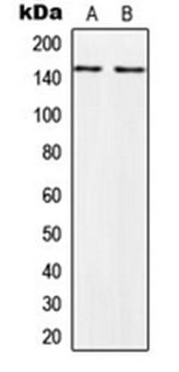 Western blot analysis of HeLa (Lane 1), PC3 (Lane 2) whole cell lysates using PALLD antibody