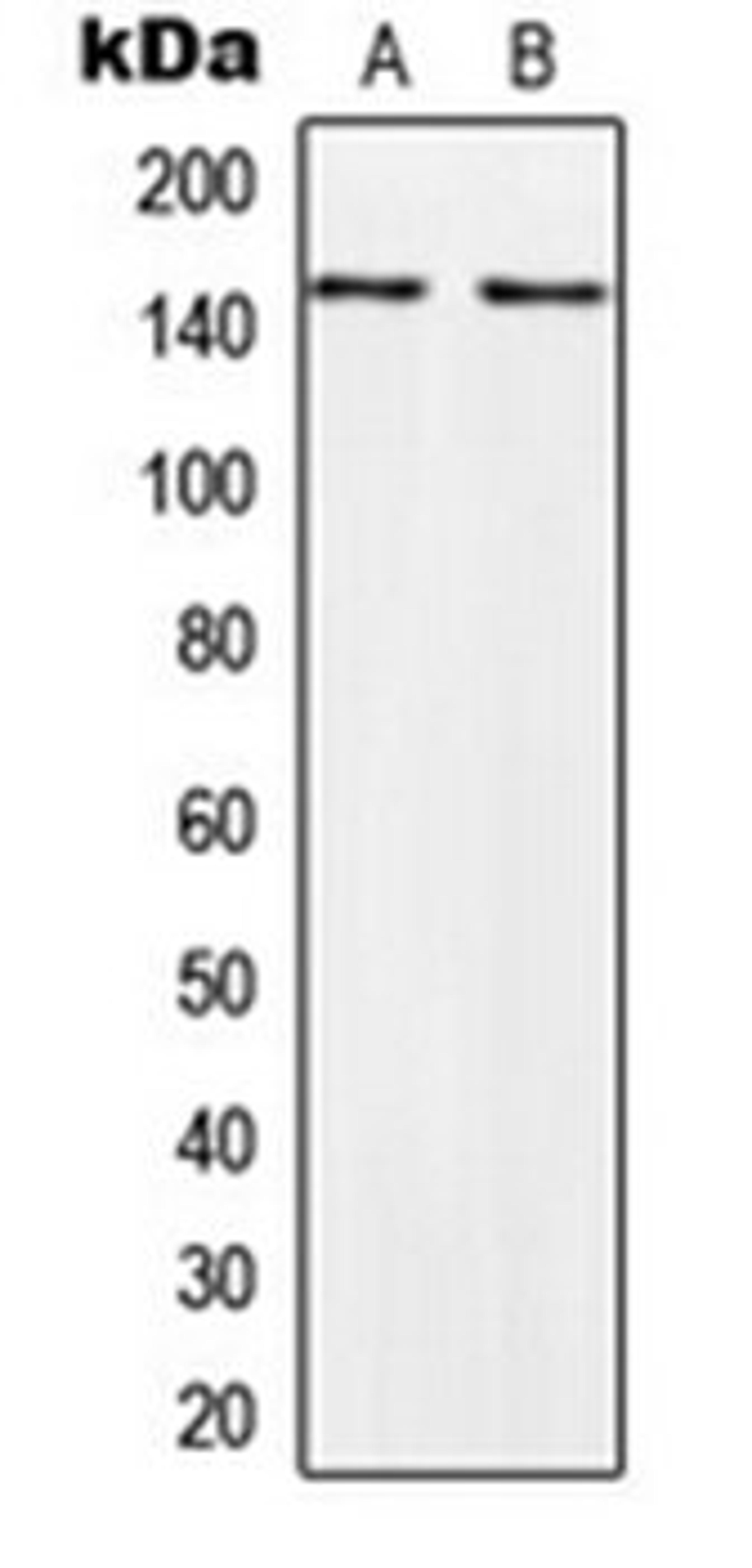 Western blot analysis of HeLa (Lane 1), PC3 (Lane 2) whole cell lysates using PALLD antibody