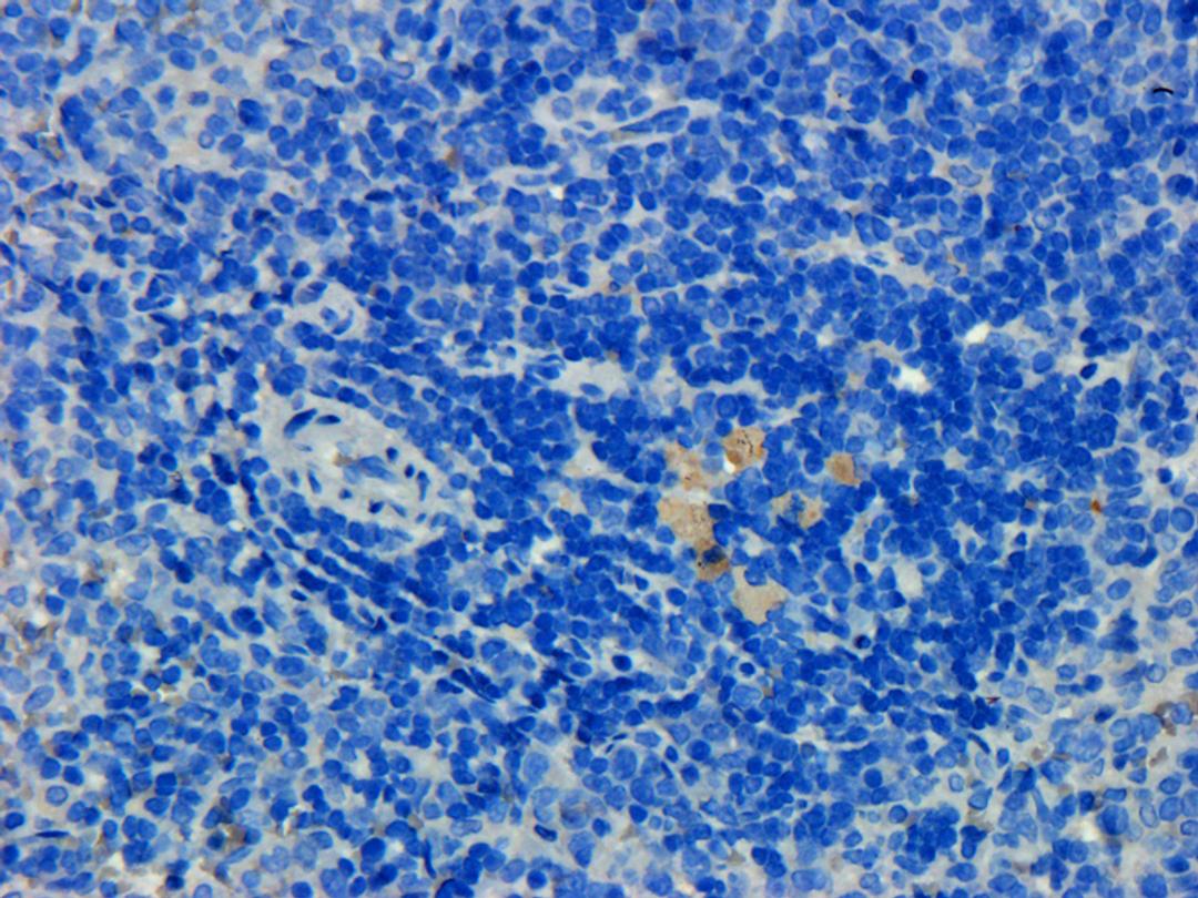 IHC-P staining of rat spleen tissue using Prostaglandin E synthase 2 antibody (dilution at 1: 200)