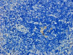 IHC-P staining of rat spleen tissue using Prostaglandin E synthase 2 antibody (dilution at 1: 200)