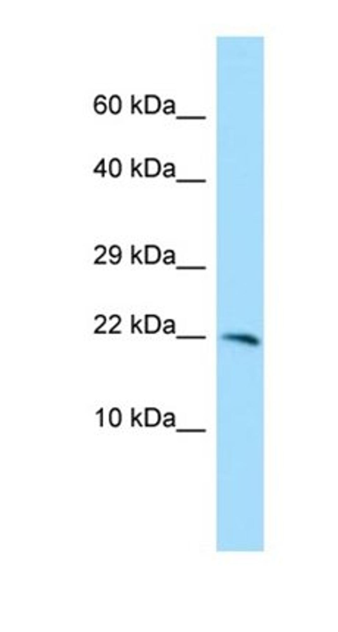 Western blot analysis of MCF7 Whole Cell tissue using CXorf40A antibody