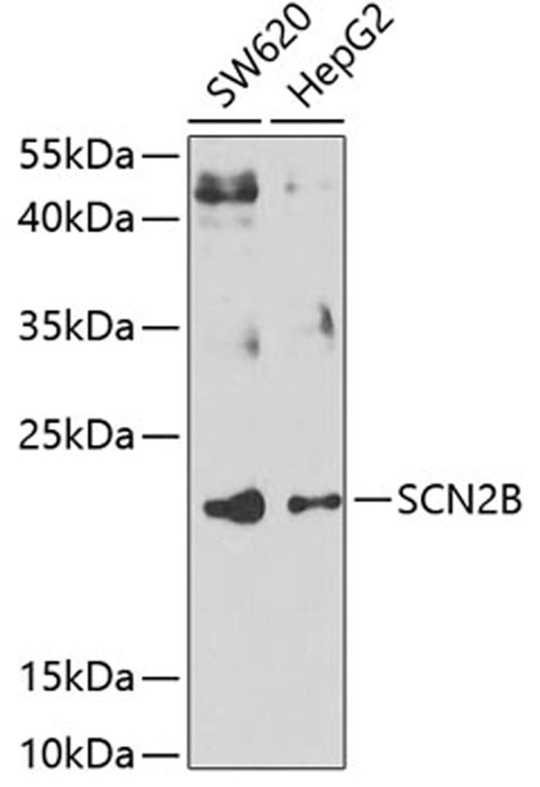 Western blot - SCN2B antibody (A7723)