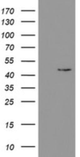 Western Blot: PHKG2 Antibody (1F9) [NBP2-46393] - Analysis of HEK293T cells were transfected with the pCMV6-ENTRY control (Left lane) or pCMV6-ENTRY PHKG2.