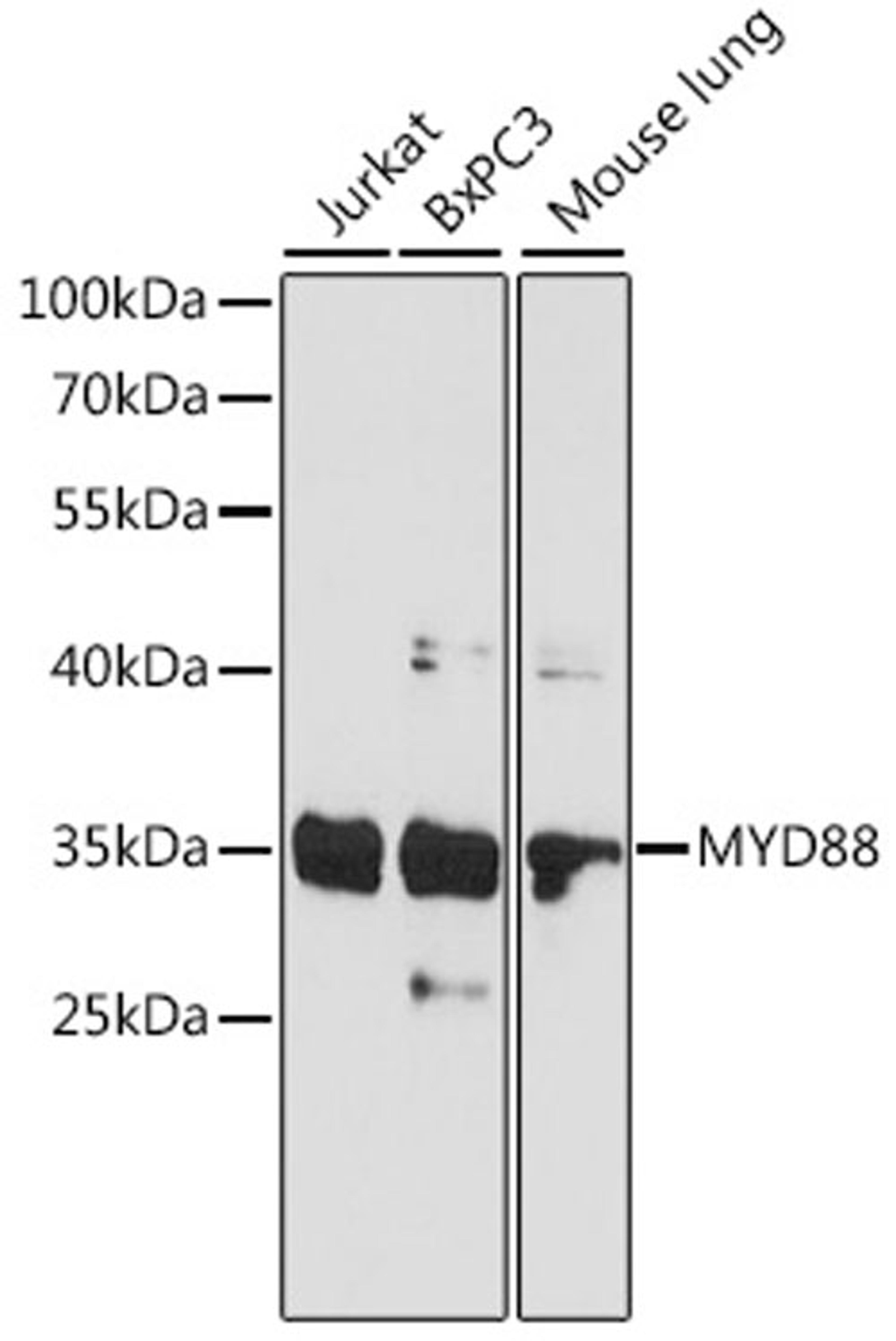 Western blot - MYD88 antibody (A16889)