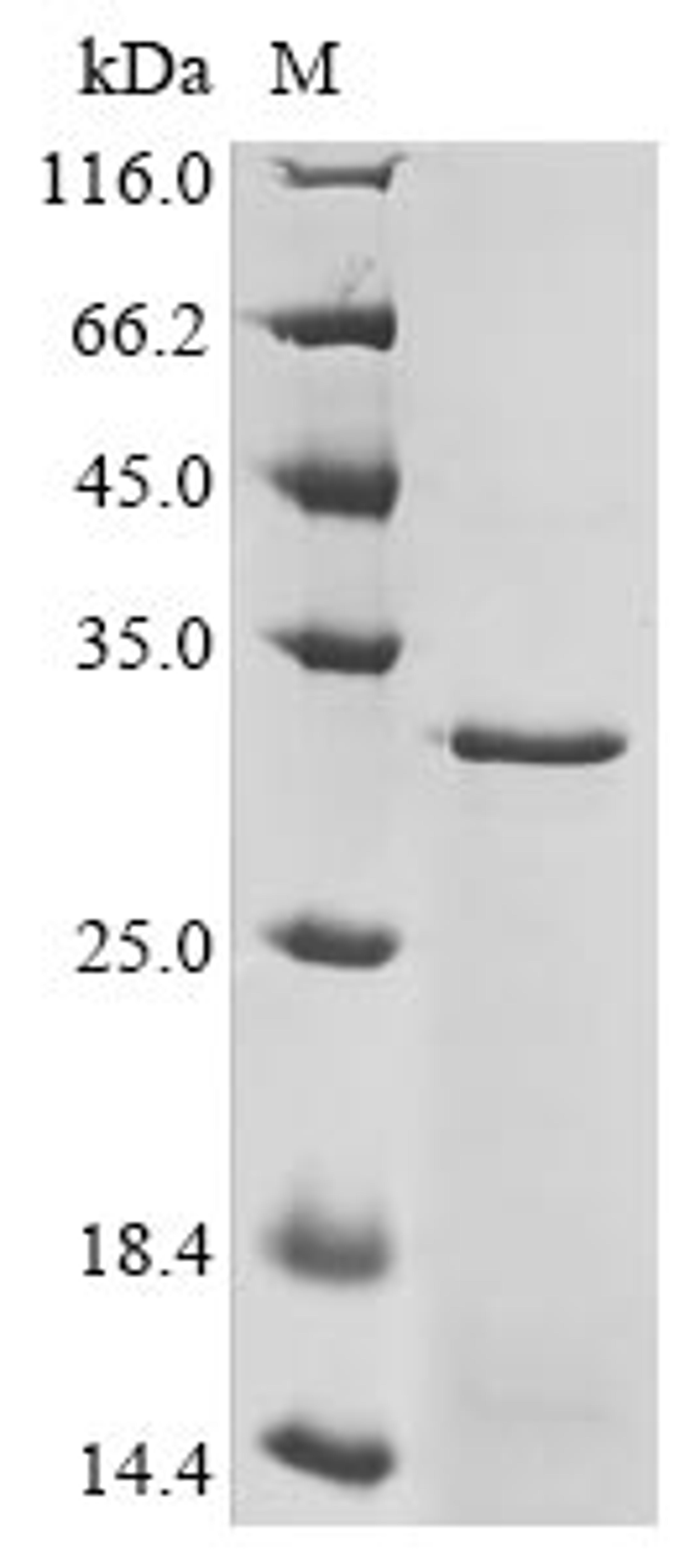 (Tris-Glycine gel) Discontinuous SDS-PAGE (reduced) with 5% enrichment gel and 15% separation gel.