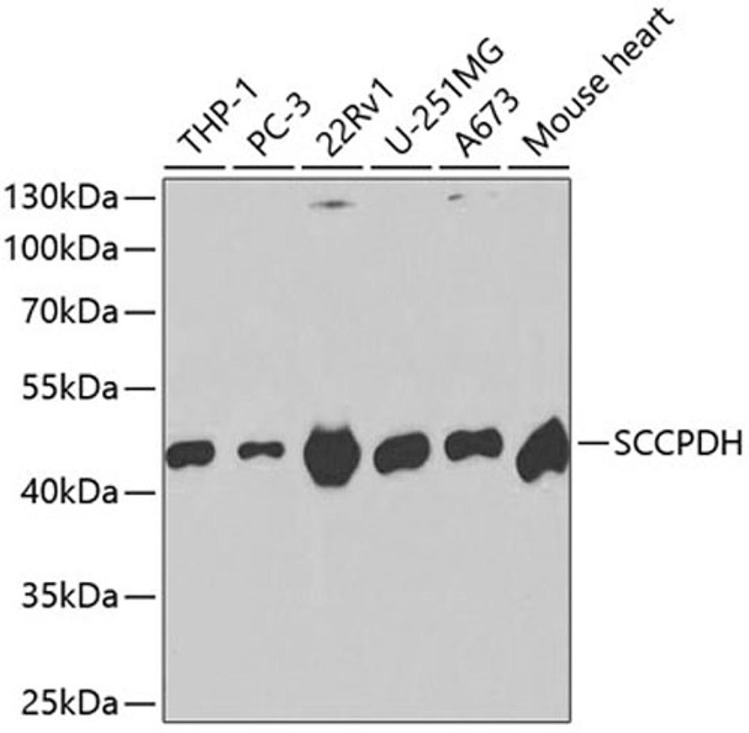 Western blot - SCCPDH antibody (A2148)