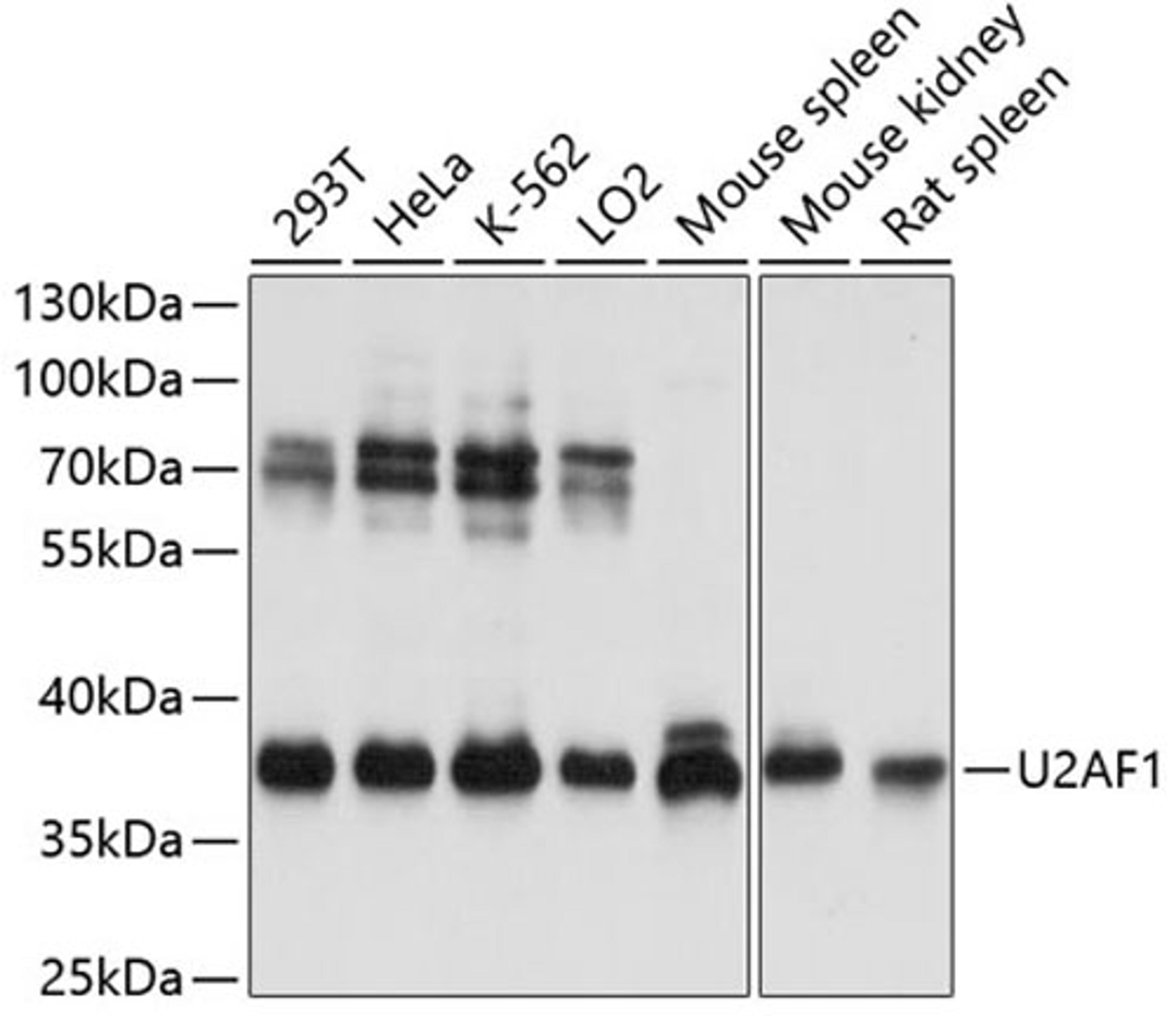 Western blot - U2AF1 antibody (A13166)