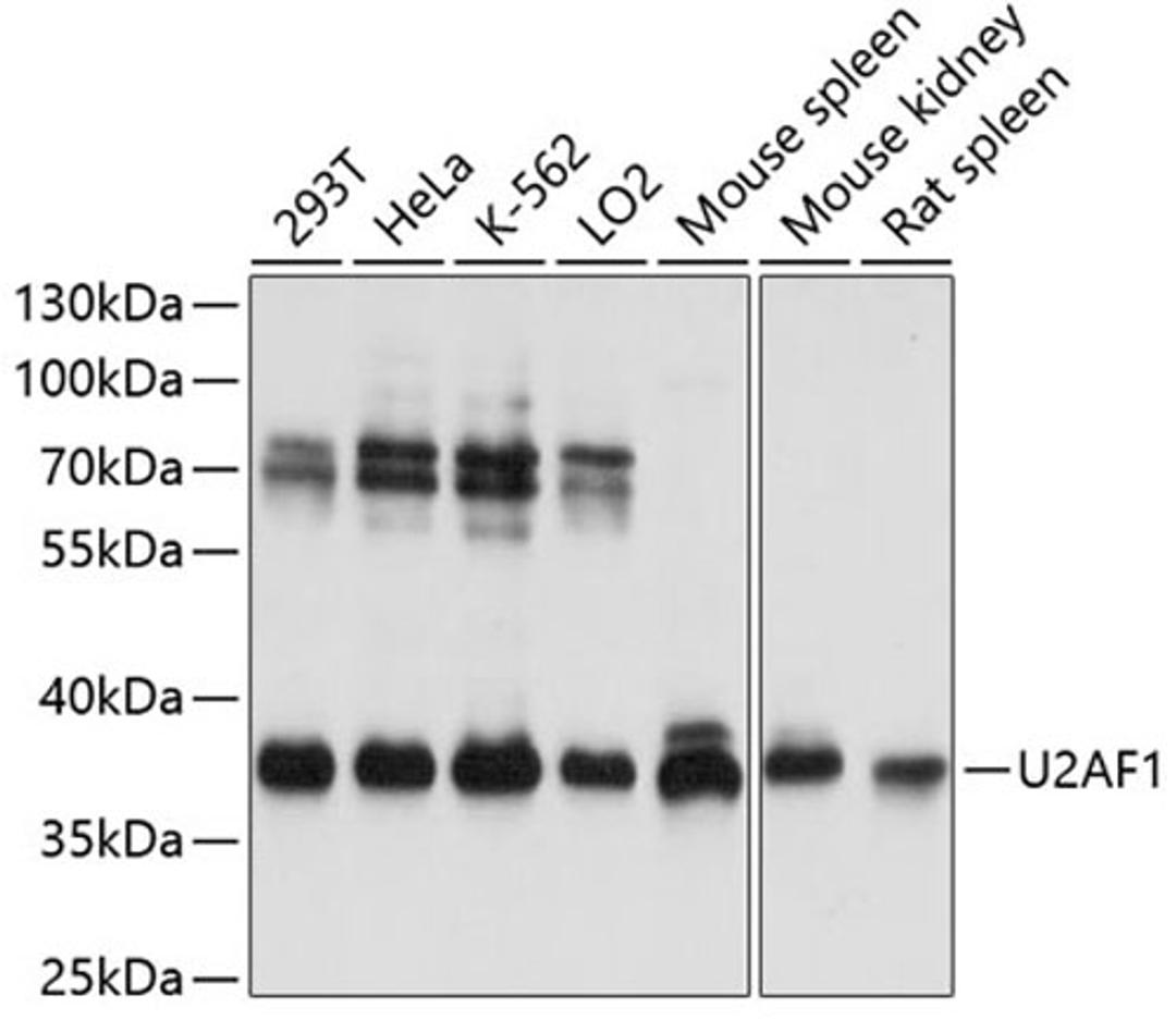 Western blot - U2AF1 antibody (A13166)