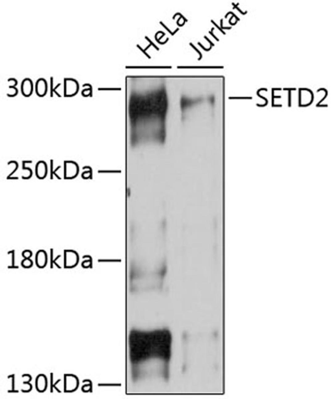 Western blot - SETD2 Antibody (A11757)