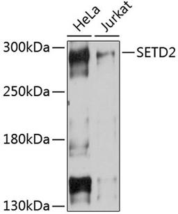 Western blot - SETD2 Antibody (A11757)