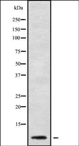 Western blot analysis of Jurkat whole cell lysates using RPL41 antibody