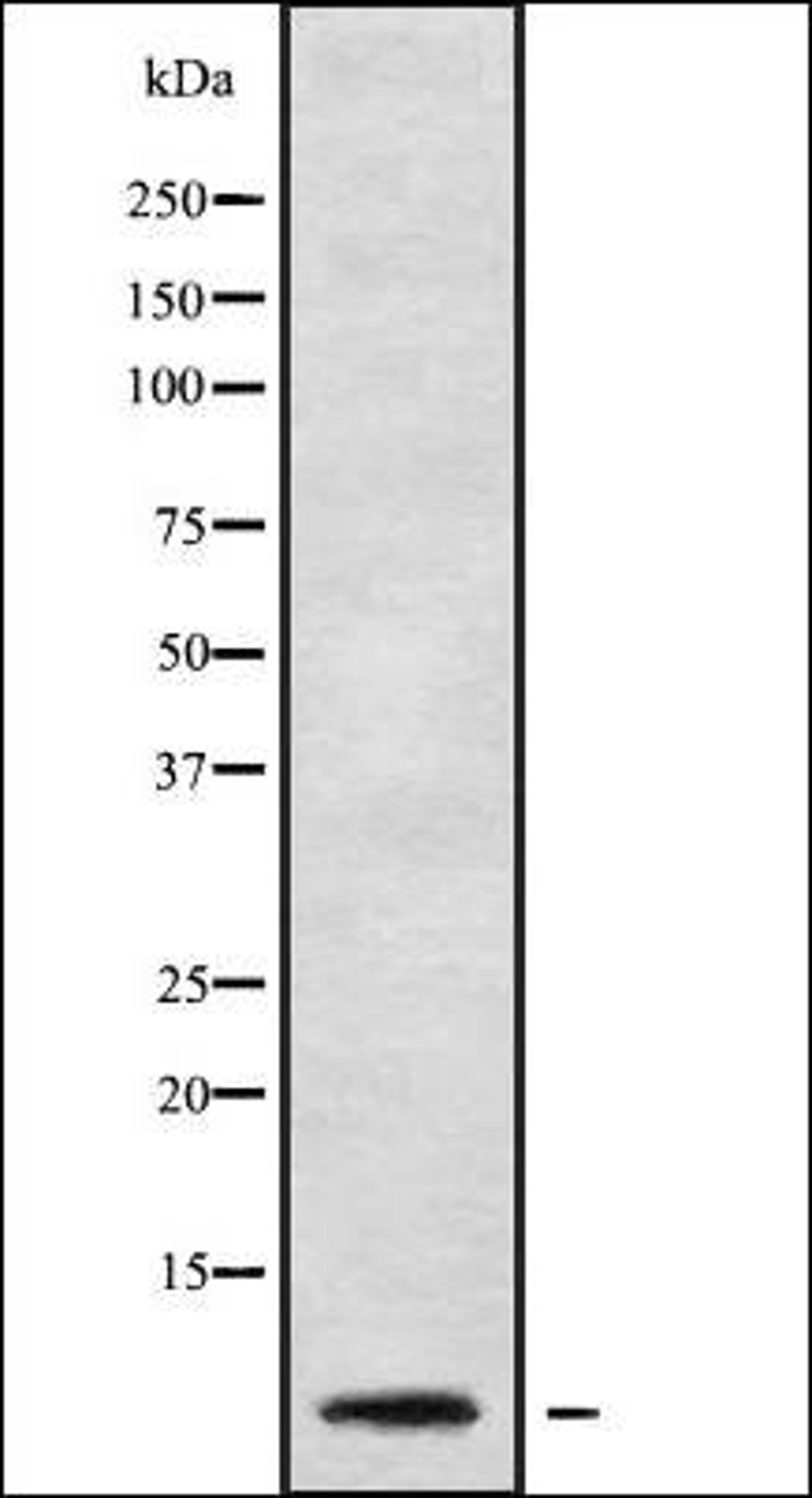 Western blot analysis of Jurkat whole cell lysates using RPL41 antibody