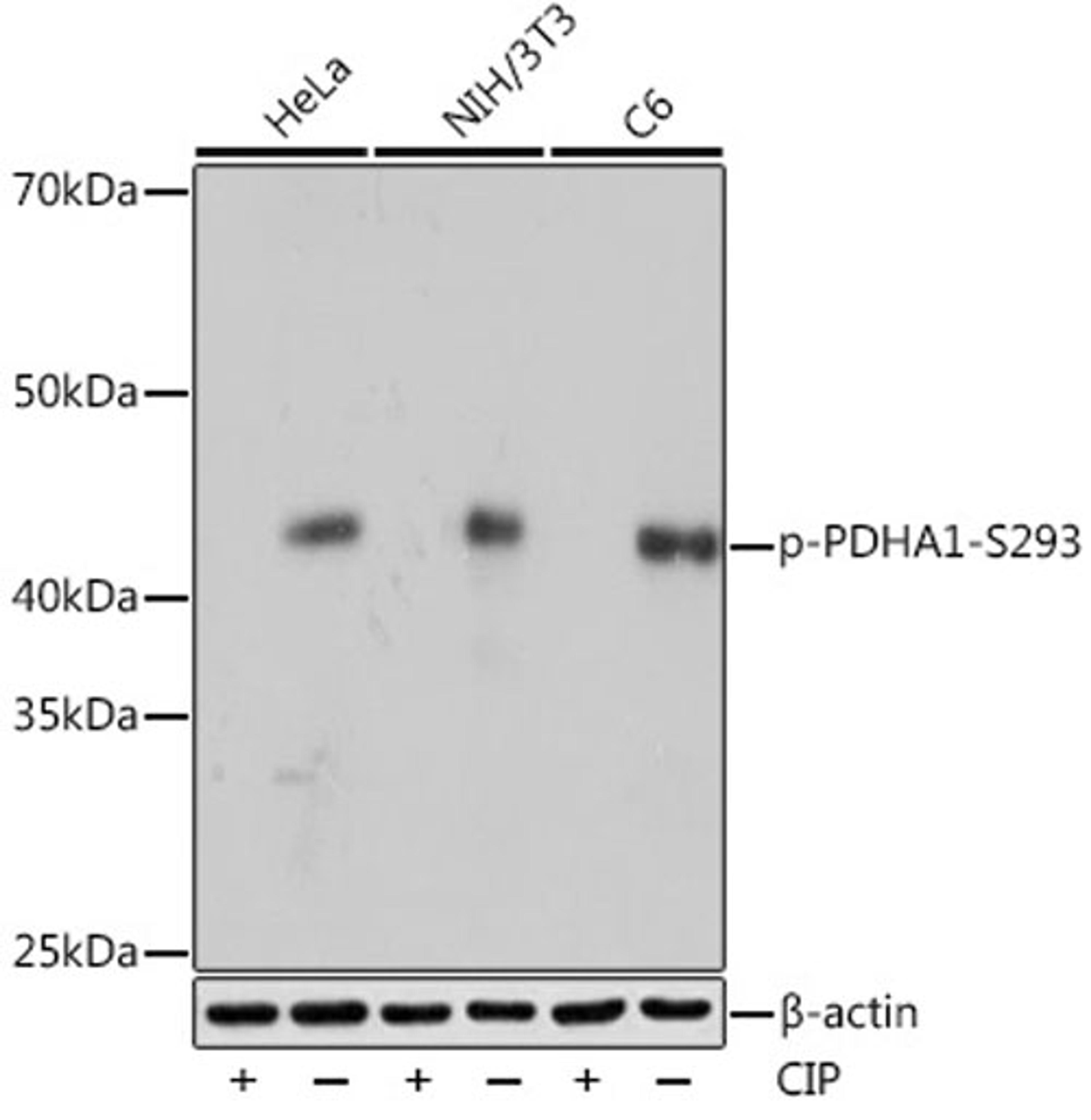 Western blot - Phospho-PDHA1-S293 Rabbit mAb (AP1022)