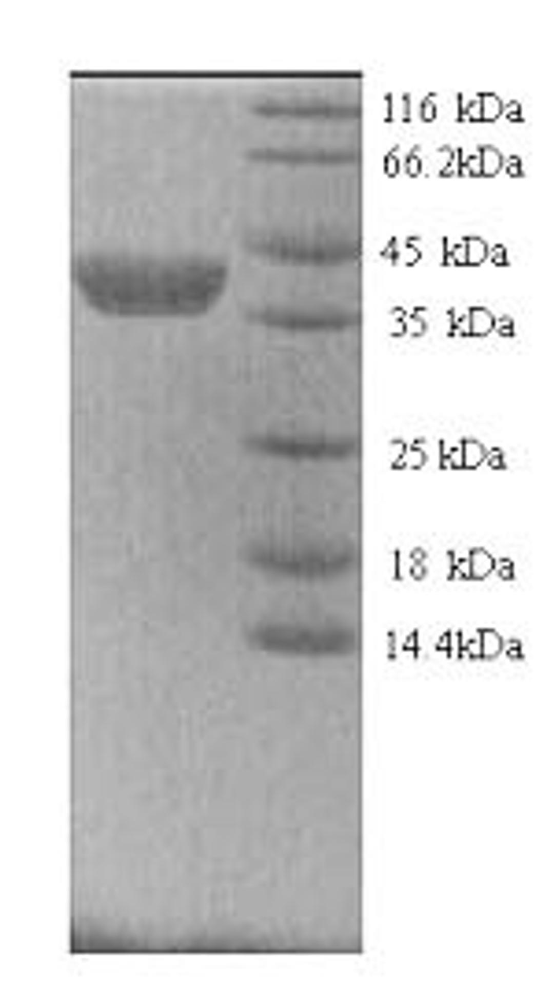 (Tris-Glycine gel) Discontinuous SDS-PAGE (reduced) with 5% enrichment gel and 15% separation gel.