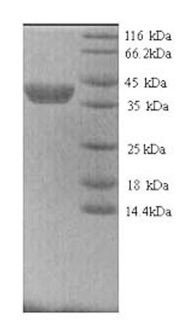 (Tris-Glycine gel) Discontinuous SDS-PAGE (reduced) with 5% enrichment gel and 15% separation gel.