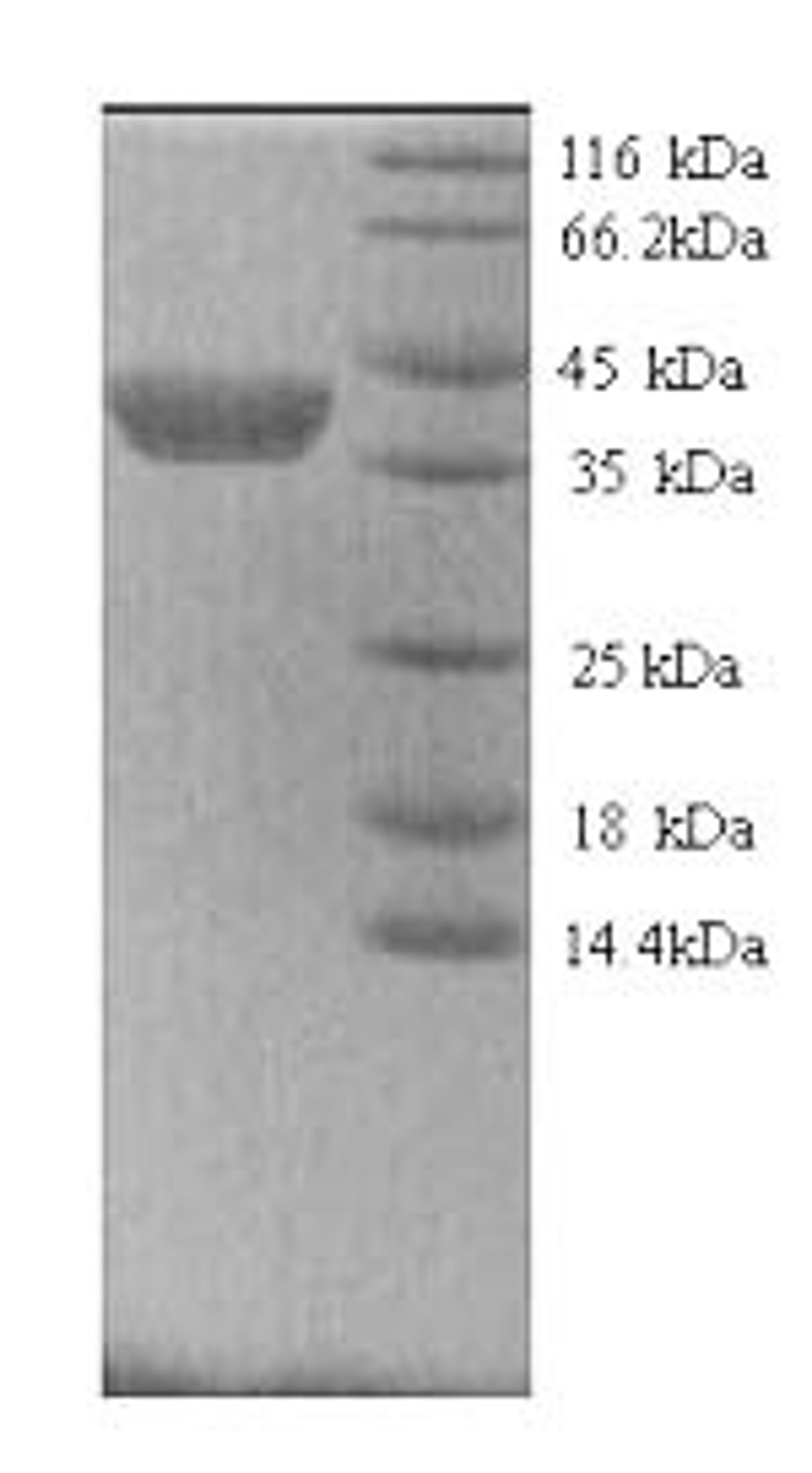 (Tris-Glycine gel) Discontinuous SDS-PAGE (reduced) with 5% enrichment gel and 15% separation gel.