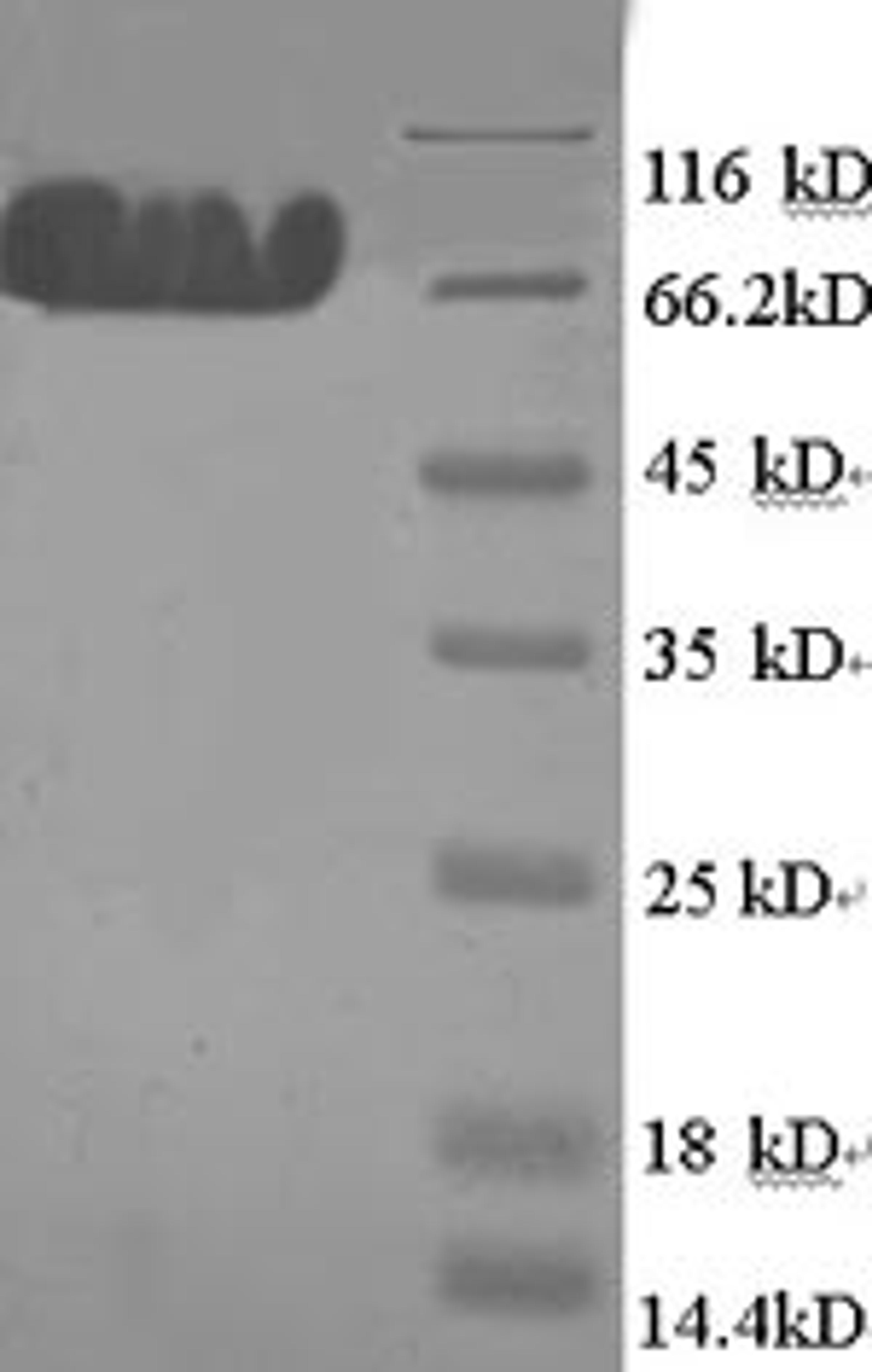 (Tris-Glycine gel) Discontinuous SDS-PAGE (reduced) with 5% enrichment gel and 15% separation gel.