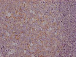 IHC image of CSB-MA916751 diluted at 1:100 and staining in paraffin-embedded human tonsil tissue performed on a Leica BondTM system. After dewaxing and hydration, antigen retrieval was mediated by high pressure in a citrate buffer (pH 6.0). Section was blocked with 10% normal goat serum 30min at RT. Then primary antibody (1% BSA) was incubated at 4°C overnight. The primary is detected by a Goat anti-mouse IgG polymer labeled by HRP and visualized using 0.05% DAB.