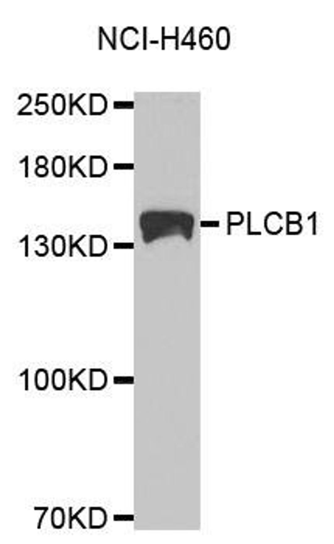 Western blot analysis of extracts of NCI-H460 cell lines using PLCB1 antibody