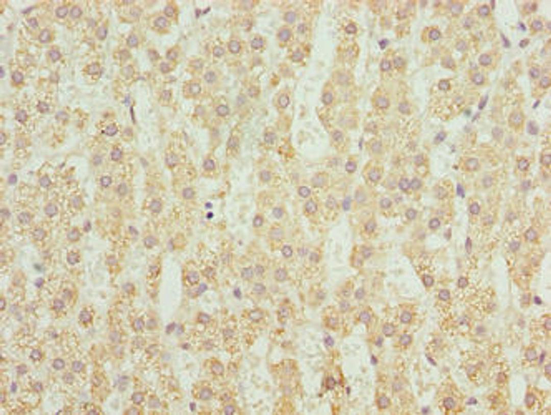 Immunohistochemistry of paraffin-embedded human adrenal gland tissue using CSB-PA847606LA01HU at dilution of 1:100