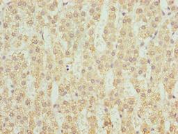 Immunohistochemistry of paraffin-embedded human adrenal gland tissue using CSB-PA847606LA01HU at dilution of 1:100