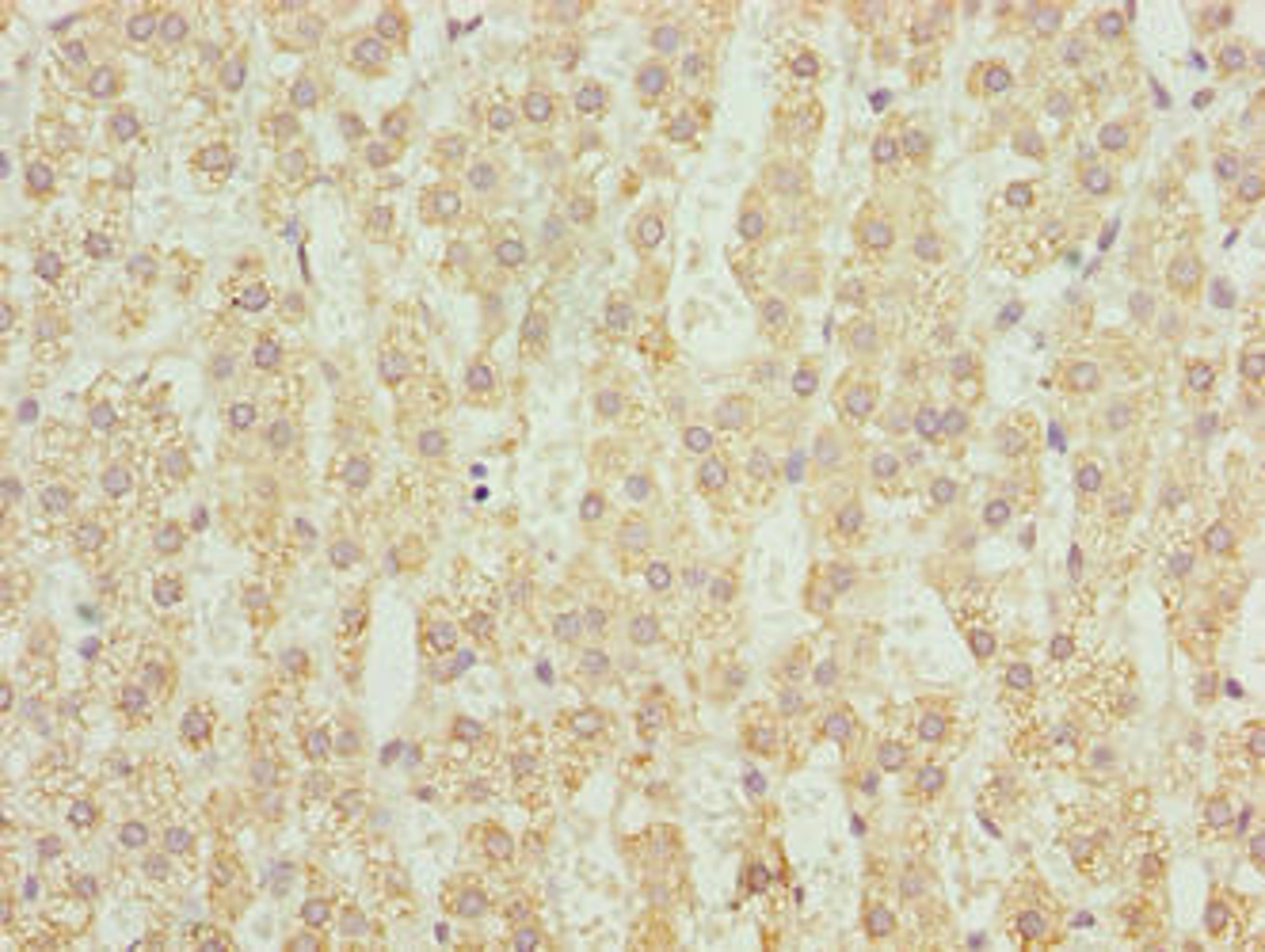 Immunohistochemistry of paraffin-embedded human adrenal gland tissue using CSB-PA847606LA01HU at dilution of 1:100