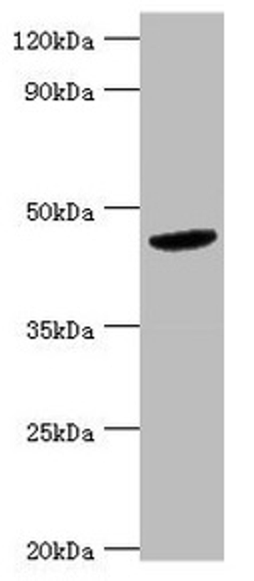 Western blot. All lanes: BCKDK antibody at 5µg/ml + Hela whole cell lysate. Secondary. Goat polyclonal to rabbit IgG at 1/10000 dilution. Predicted band size: 47, 38, 42 kDa. Observed band size: 47 kDa