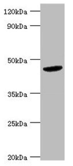 Western blot. All lanes: BCKDK antibody at 5µg/ml + Hela whole cell lysate. Secondary. Goat polyclonal to rabbit IgG at 1/10000 dilution. Predicted band size: 47, 38, 42 kDa. Observed band size: 47 kDa