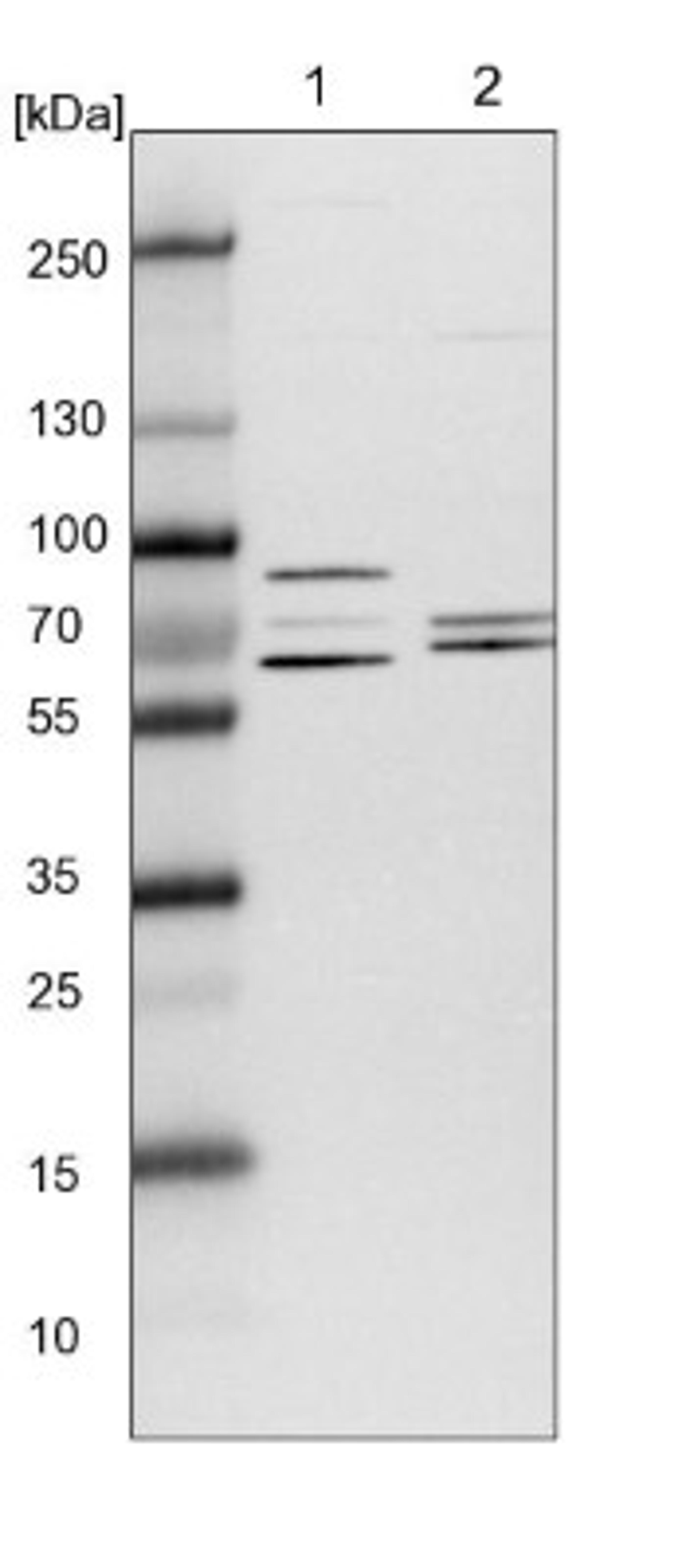 Western Blot: TCP1 alpha Antibody [NBP1-88148] - Lane 1: NIH-3T3 cell lysate (Mouse embryonic fibroblast cells)<br/>Lane 2: NBT-II cell lysate (Rat Wistar bladder tumour cells)