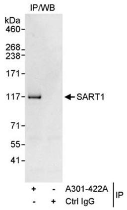 Detection of human SART1 by western blot of immunoprecipitates.