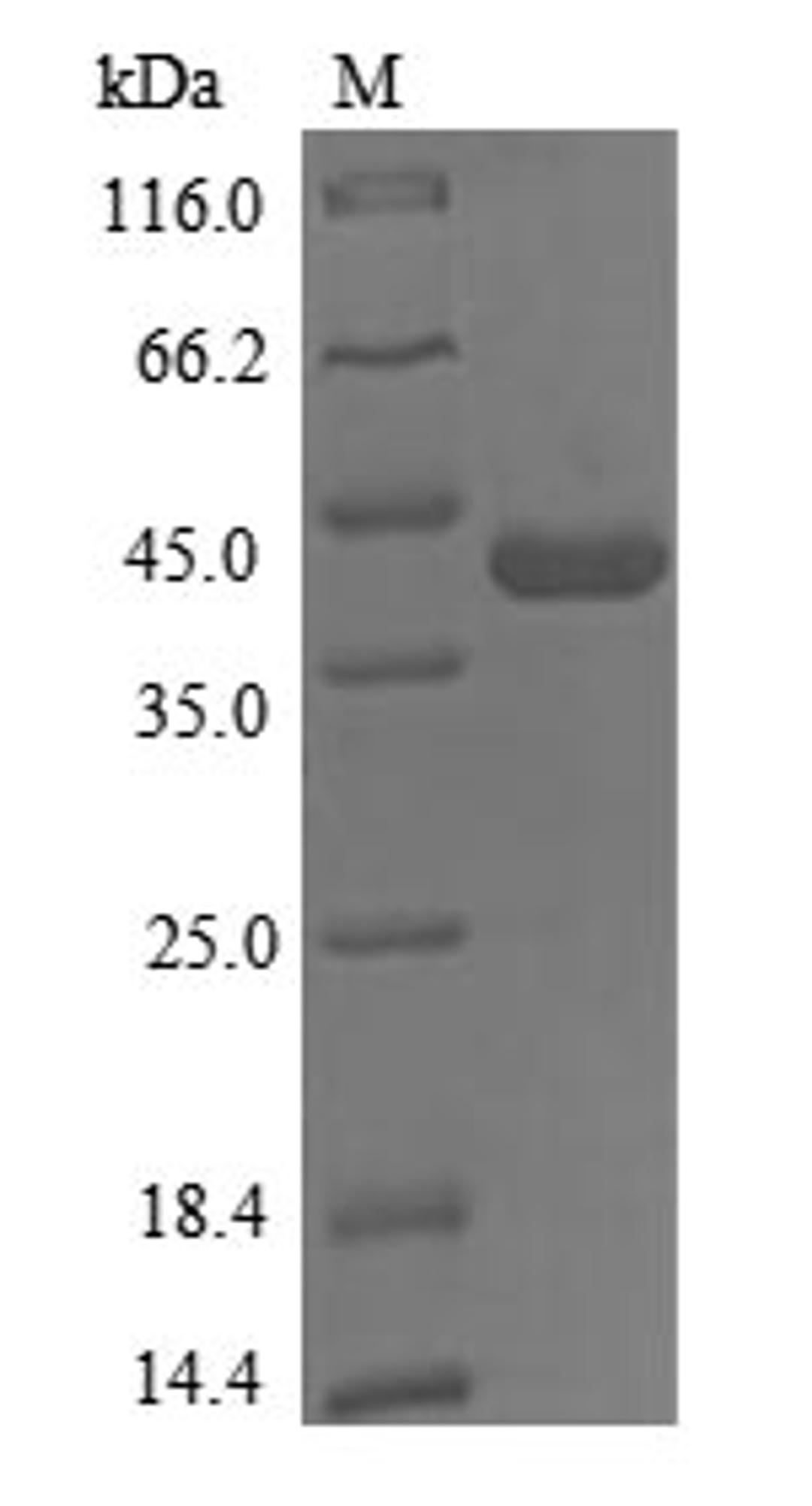 (Tris-Glycine gel) Discontinuous SDS-PAGE (reduced) with 5% enrichment gel and 15% separation gel.