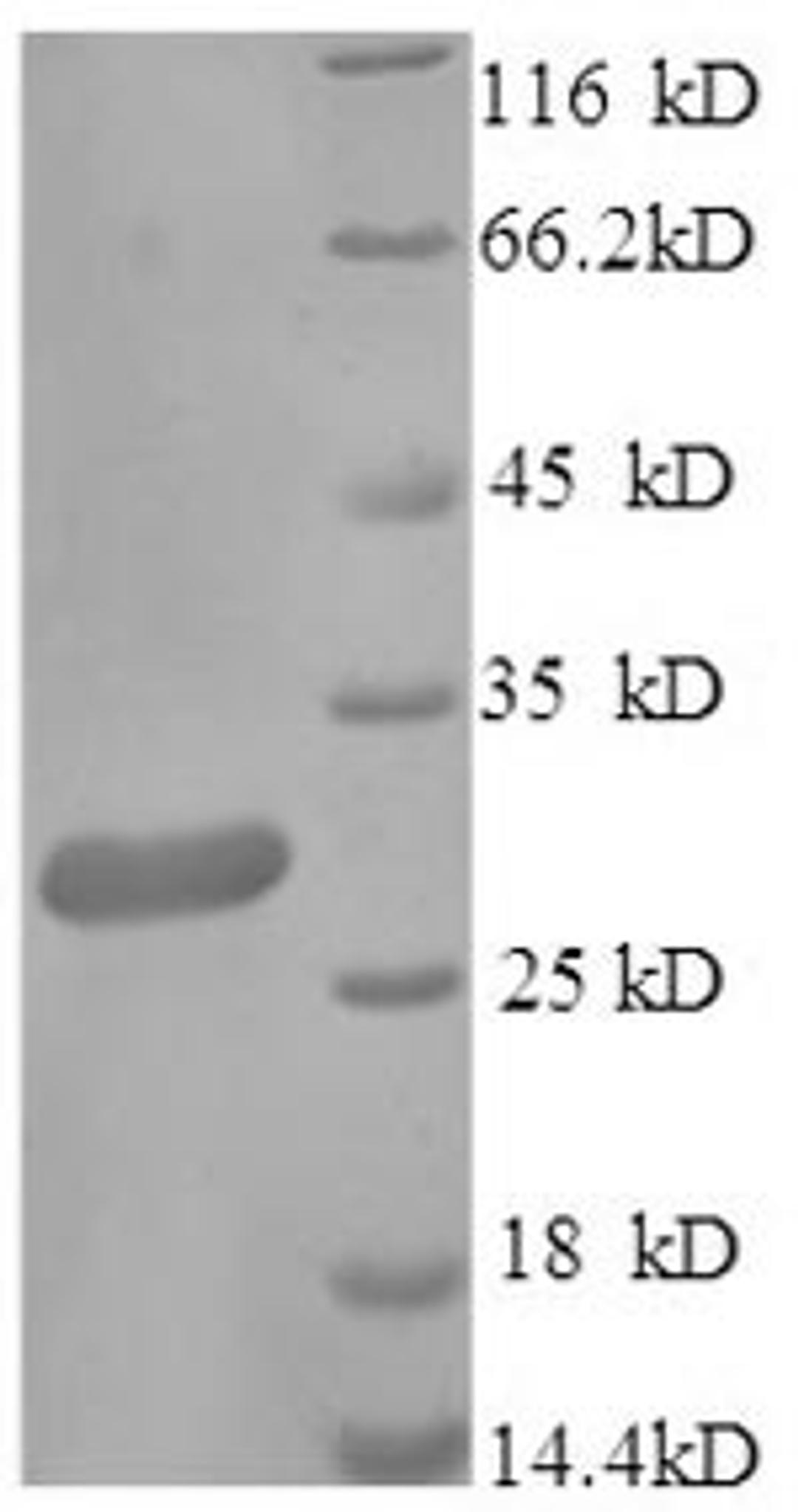 (Tris-Glycine gel) Discontinuous SDS-PAGE (reduced) with 5% enrichment gel and 15% separation gel.