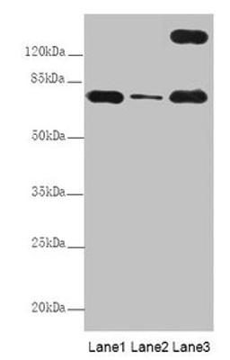 Western Blot. All lanes: TTC12 antibody at 8µg/ml. Lane 1: Mouse large intestine tissue. Lane 2: Mouse small intestine tissue. Lane 3: HepG2 whole cell lysate. Secondary. Goat polyclonal to rabbit IgG at 1/10000 dilution. Predicted band size: 79, 82 kDa. Observed band size: 79, 170 kDa