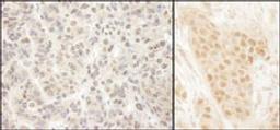 Detection of human MCAK by immunohistochemistry.