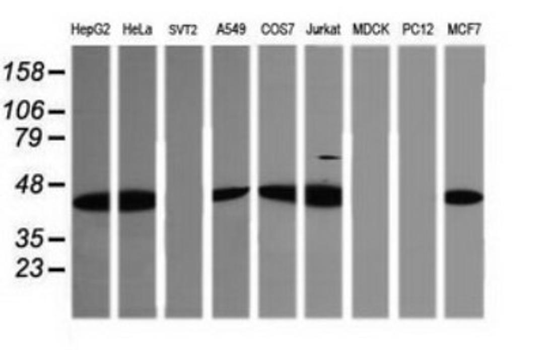 Western Blot: TRIM38 Antibody (3D3) [NBP2-46215] - Analysis of extracts (35ug) from 9 different cell lines by using TRIM38 monoclonal antibody (HepG2: human; HeLa: human; SVT2: mouse; A549: human; COS7: monkey; Jurkat: human; MDCK: canine; PC12: rat; MCF7: human).