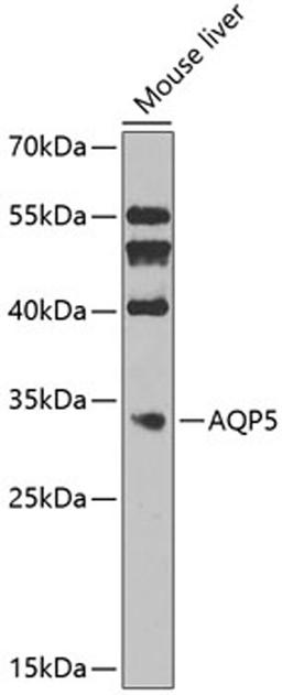 Western blot - AQP5 Antibody (A9927)