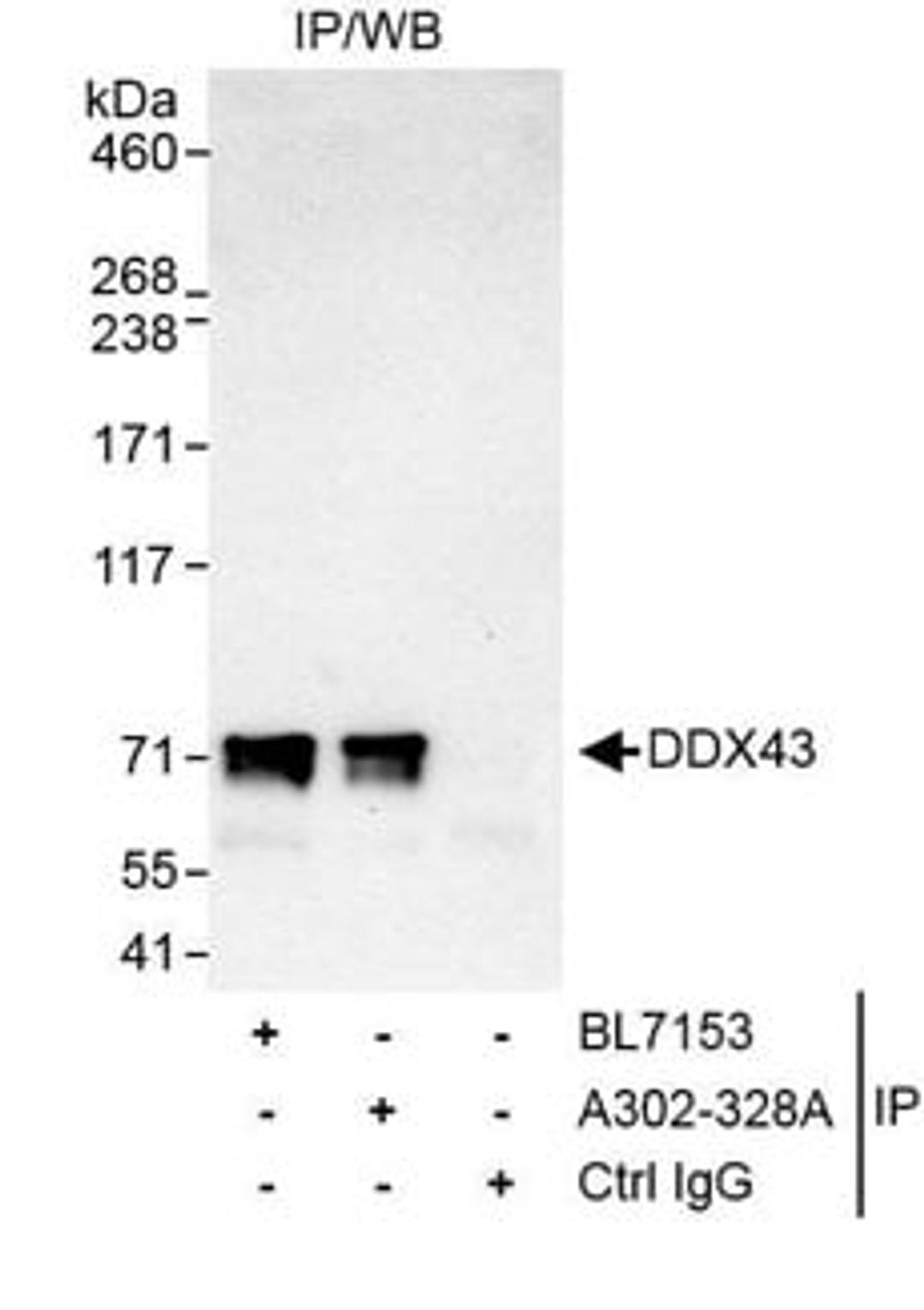 Detection of human DDX43 by western blot of immunoprecipitates.