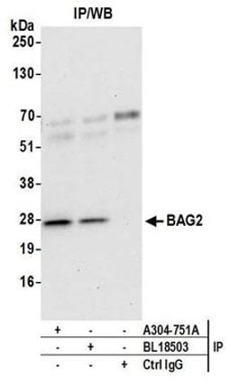 Detection of human BAG2 by western blot of immunoprecipitates.