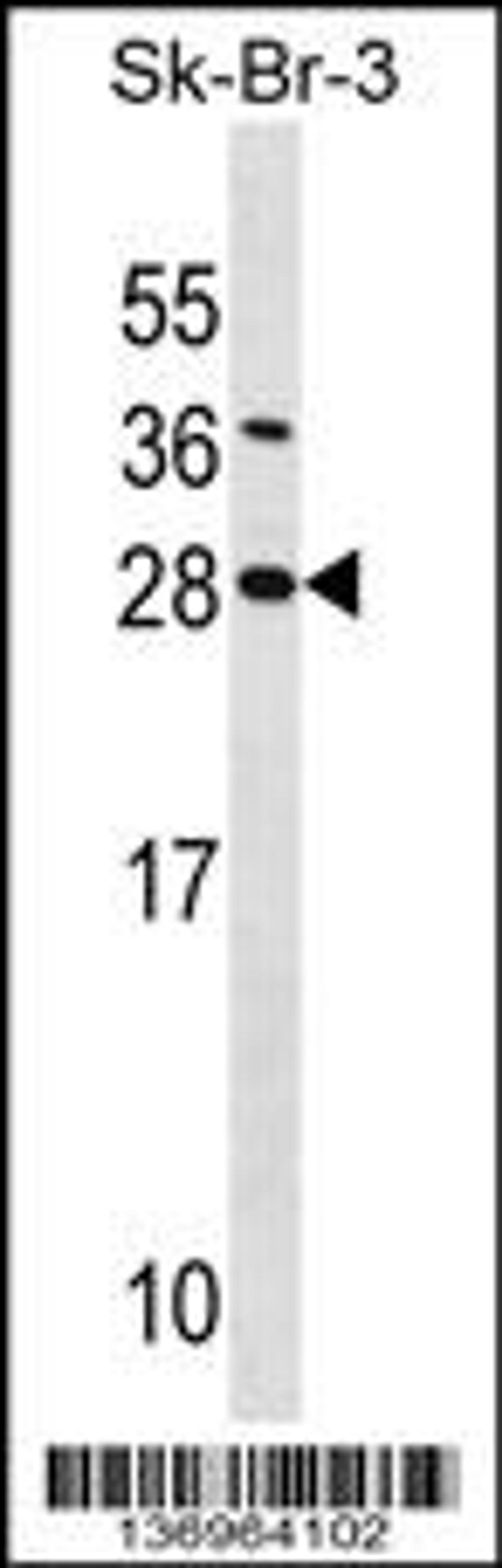 Western blot analysis in SK-BR-3 cell line lysates (35ug/lane).