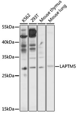 Western blot - LAPTM5 antibody (A17995)