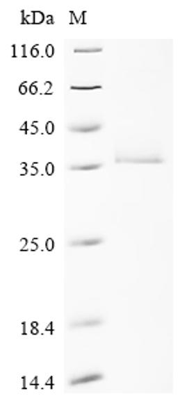 (Tris-Glycine gel) Discontinuous SDS-PAGE (reduced) with 5% enrichment gel and 15% separation gel.