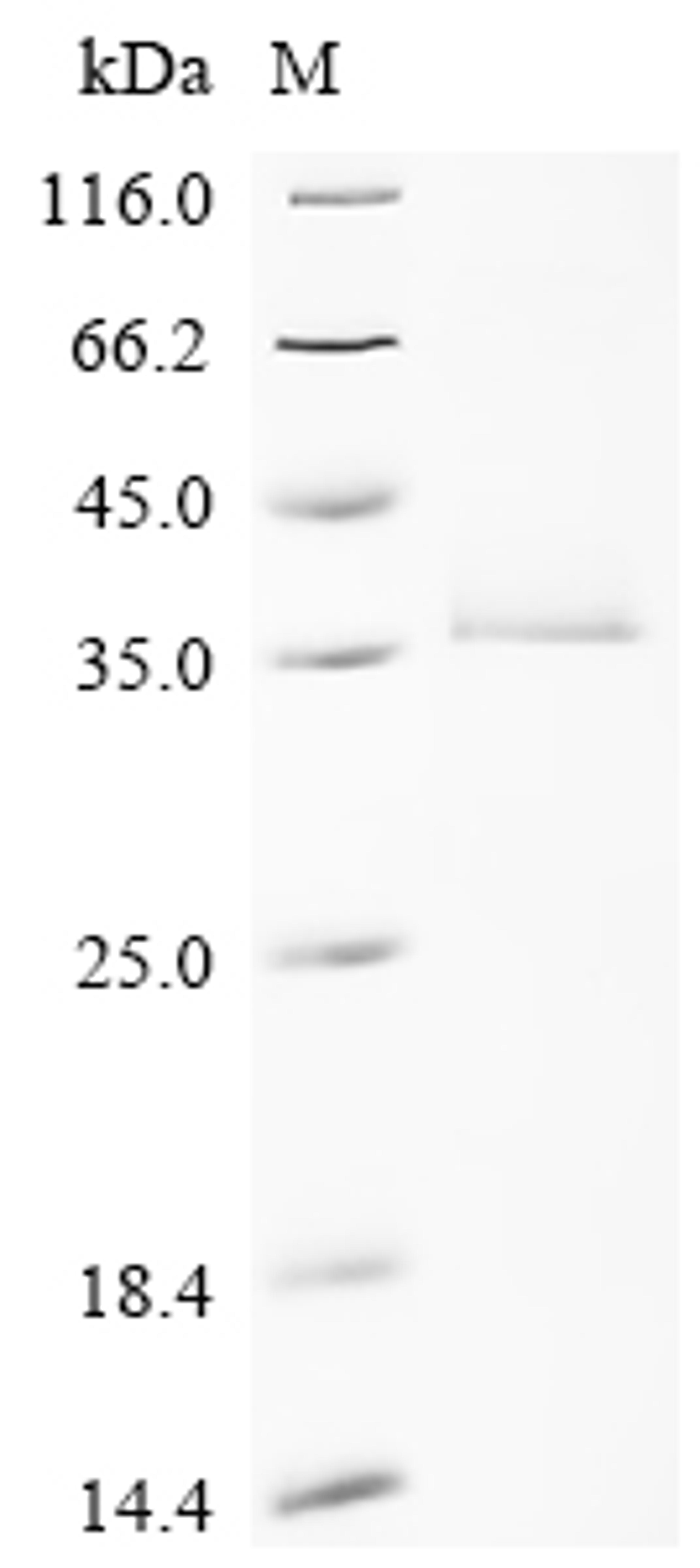 (Tris-Glycine gel) Discontinuous SDS-PAGE (reduced) with 5% enrichment gel and 15% separation gel.