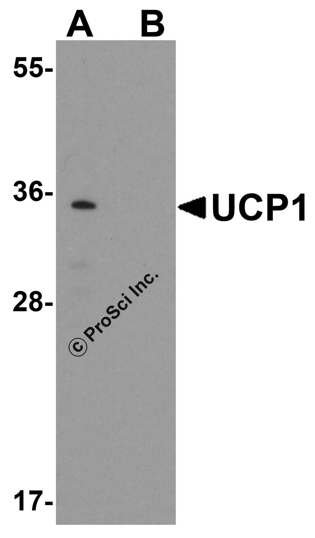 Western blot analysis of UCP1 in human brain tissue lysate with UCP1 antibody at 1 μg/mL in (A) the absence and (B) the presence of blocking peptide.