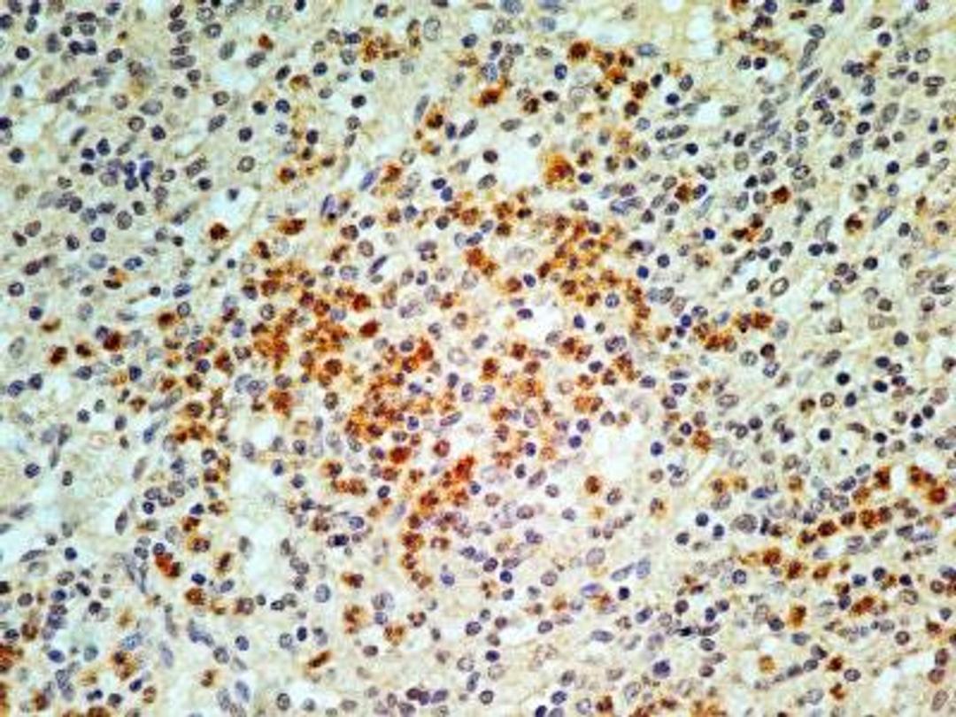 Immunohistochemistry-Paraffin: IL33 Antibody (1C5) [NBP2-31145] - IL33 Antibody (1C5) [NBP2-31145] - IHC-P analysis of IL33 protein in normal human spleen tissue sections using IL33 antibody (clone 1C5) at a concentration of 5 ug/ml. This antibody stained the nuclei as well as the cytoplasm of granulocytes and some other cell types in the red pulp of spleen tissue.