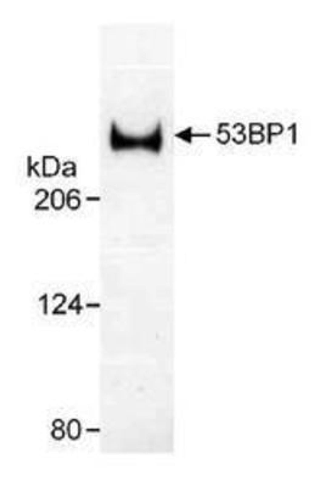 Western Blot: 53BP1 Antibody [NB100-305] - Western Blot analysis of human 53BP1, using NB100-305. Sample: Whole cell lysate (20 ug/lane) from U2Os cells resolved on a 3 to 8 percent trisacetate gel.