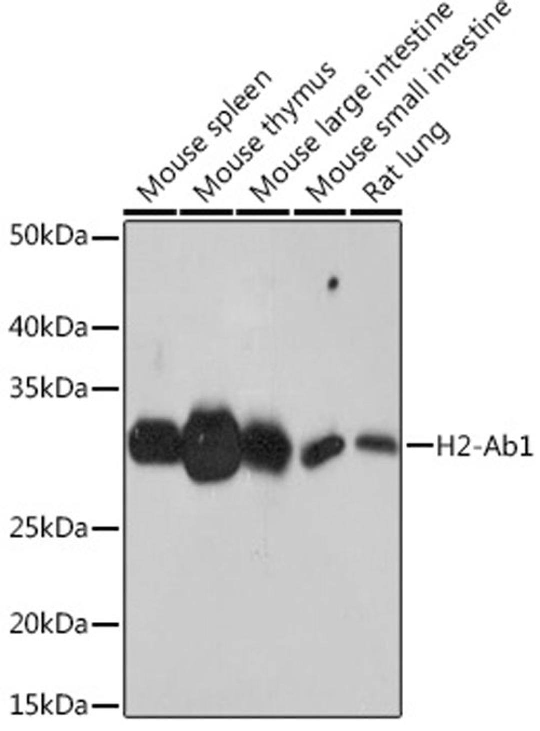 Western blot - H2-Ab1 antibody (A18658)